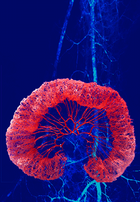 AI-enabled imaging product suite for stroke and aneurysm detection