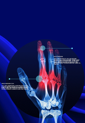 Operationalized an AI-driven clinical decision support system for early diagnosis